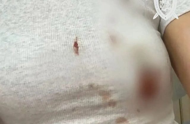 После нападения бродячих собак на жительницу Ессентуков начали проверку