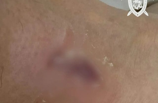 В Минводах начали проверку после нападения бездомной собаки на женщину